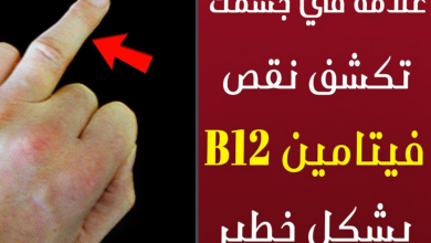 ما هي أعراض نقص فيتامين B12