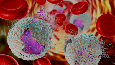 علاج yeast cells في البراز وما أسباب ظهورها